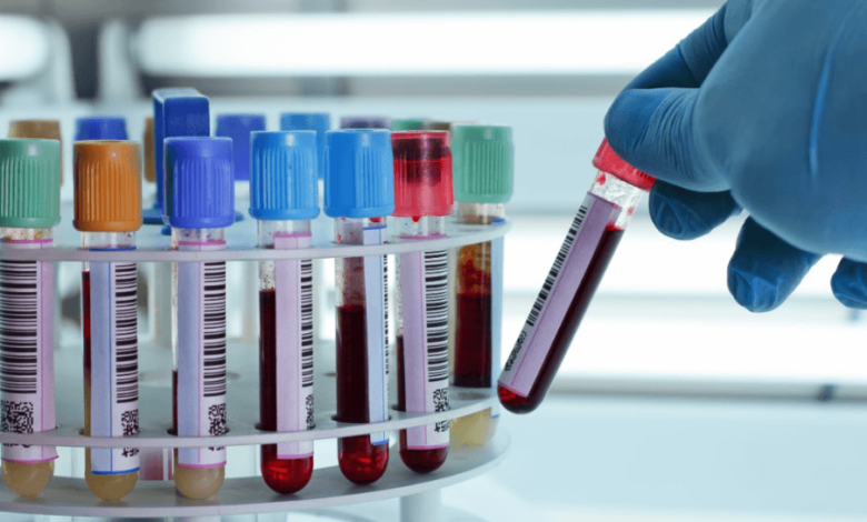 10 Essential Lab Tests You Can Now Do from the Comfort of Your Home
