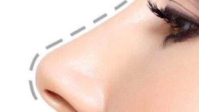Rhinoplasty in Dubai